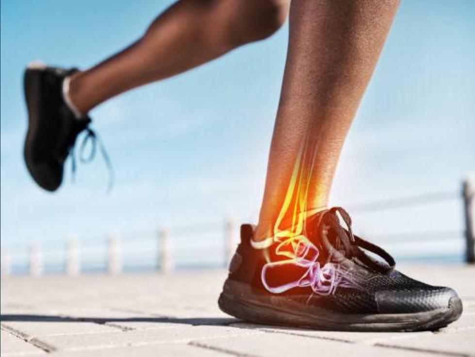 appoggio del piede nel runner